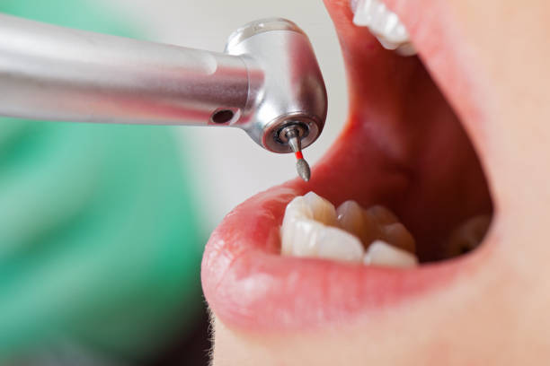 Best Emergency Cosmetic Dentistry (e.g., broken veneers) in Royse City, TX